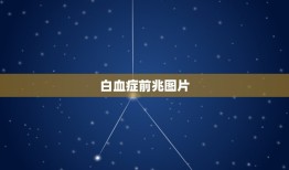 白血症前兆图片，白血症的症状是什么阿！